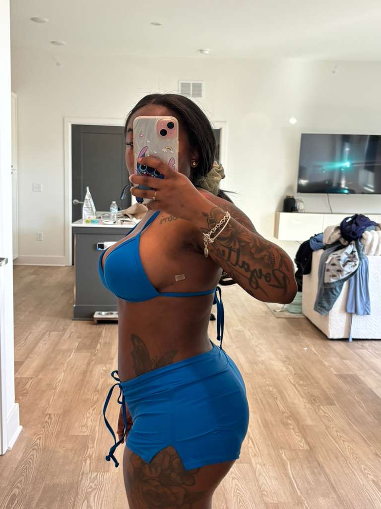 Liposuction